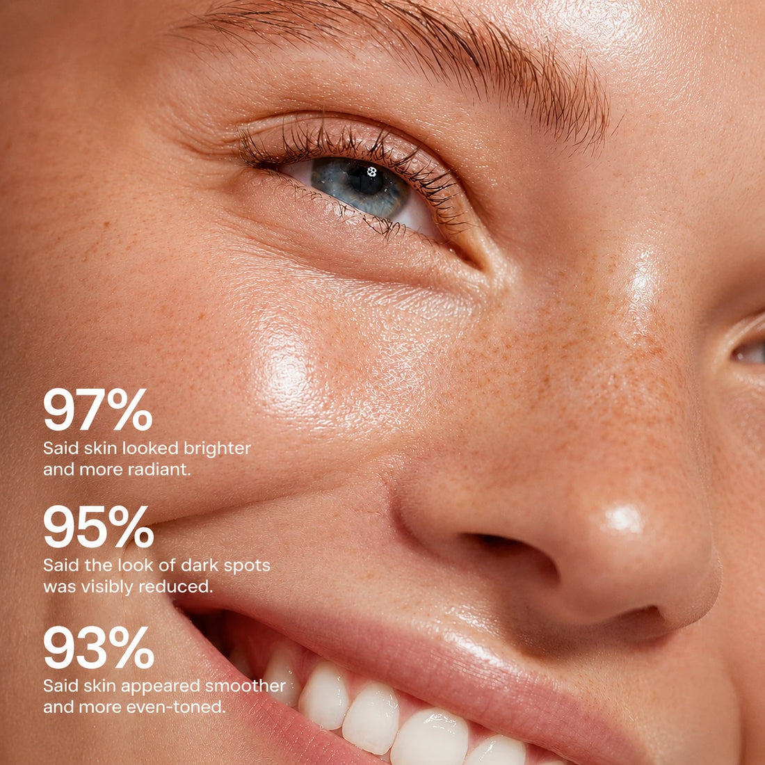 Niacinamide Dark Spot Correcting &amp; Brightening Essence |35ml