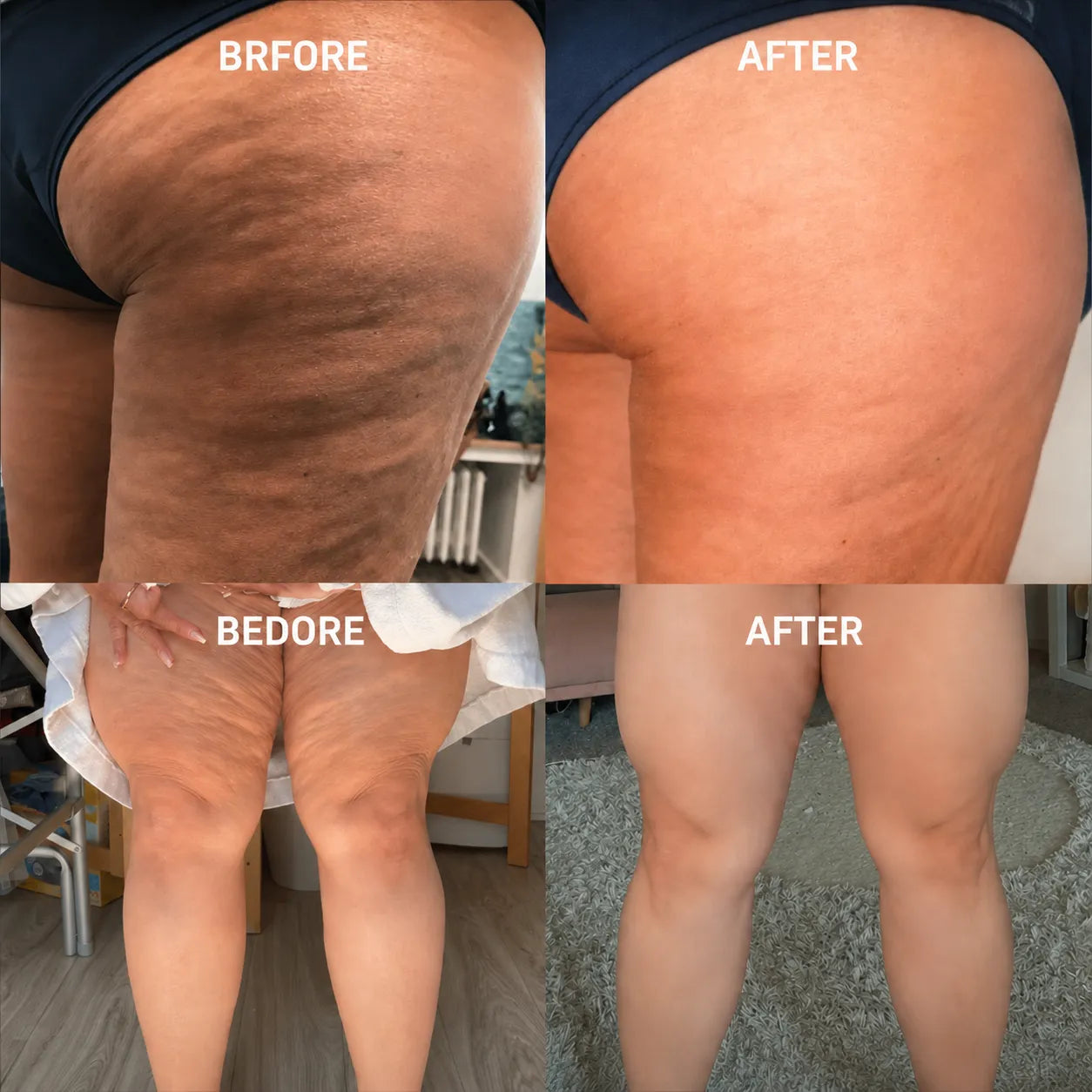 Cryo thermo gold body firming gel
