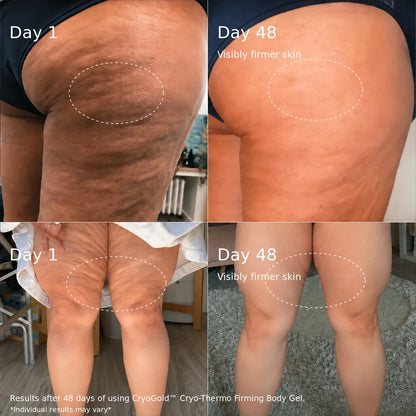 CryoGold™ Cryo-Thermo Firming Body Gel | 200g